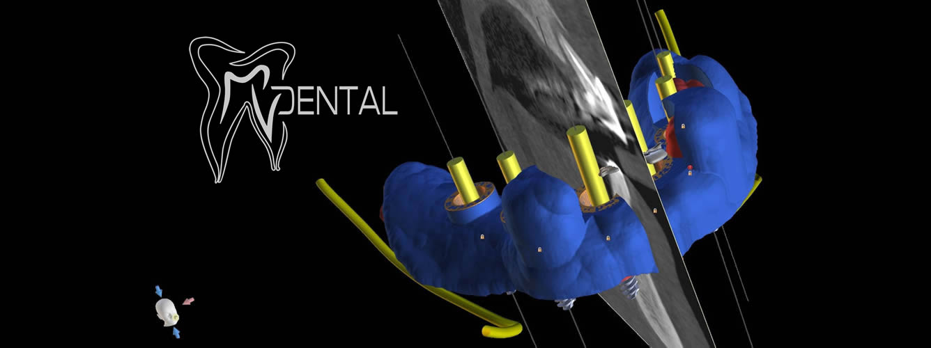 Laboratorio con cam 3D