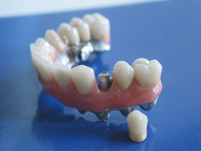 elementi-singoli-in-ceramica